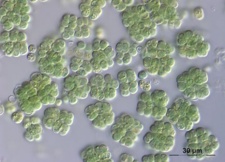 Unter dem Mikroskop werden die einzelligen Felskugeln der Art Chroococidiopsis cubana sichtbar, die von Gallerthüllen umgeben sind. Die Gallerthüllen schützen das Cyanobakterium vor extremer Austrocknung und übermäßiger Sonneneinstrahlung. Foto: Tatyana Darienko, Universität Göttingen (SAG-Nr. 39.79)